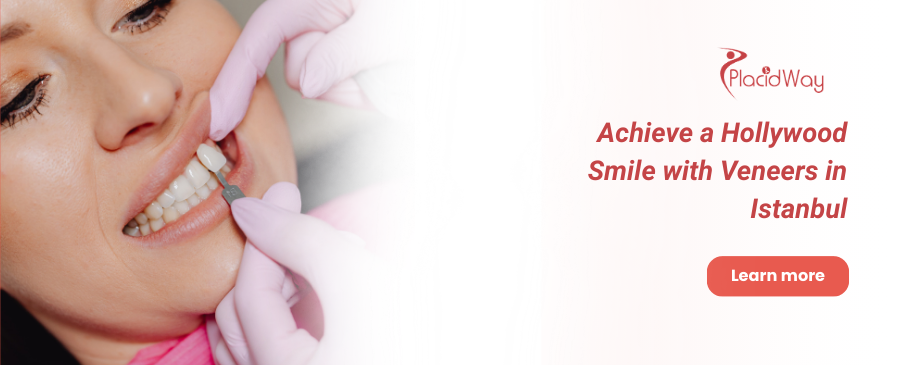 Carillas dentales en Estambul