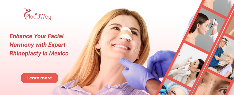 Rinoplastia en Mérida, México