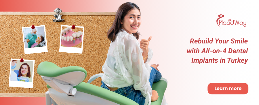 Implantes dentales All on 4 en Turquía