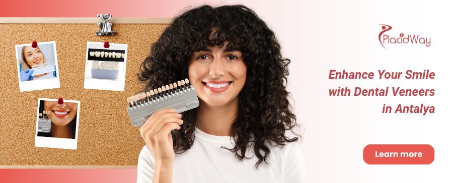 Carillas dentales en Antalya